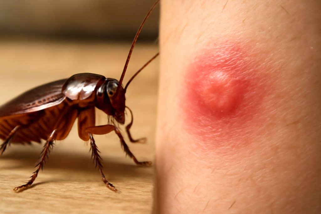 picadura de cucarachas
